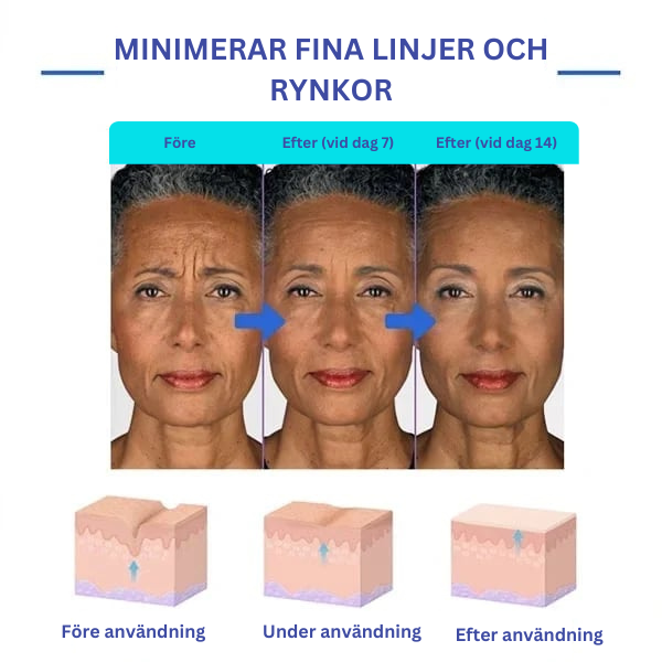 Botox ansiktsserum™