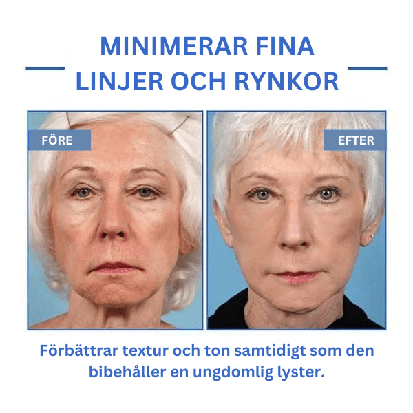 Botox ansiktsserum™