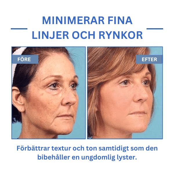 Botox ansiktsserum™