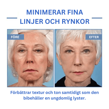 Botox Anti-Aging Serum