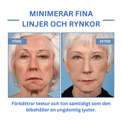 Alvobutik ™ - Botox ansiktsserum
