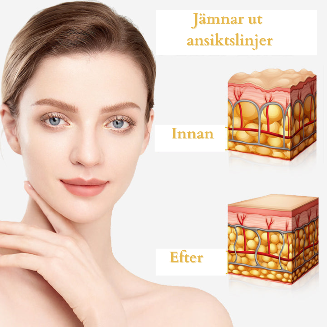 UltraRenew ultraljudsenhet för ansiktslyftning™