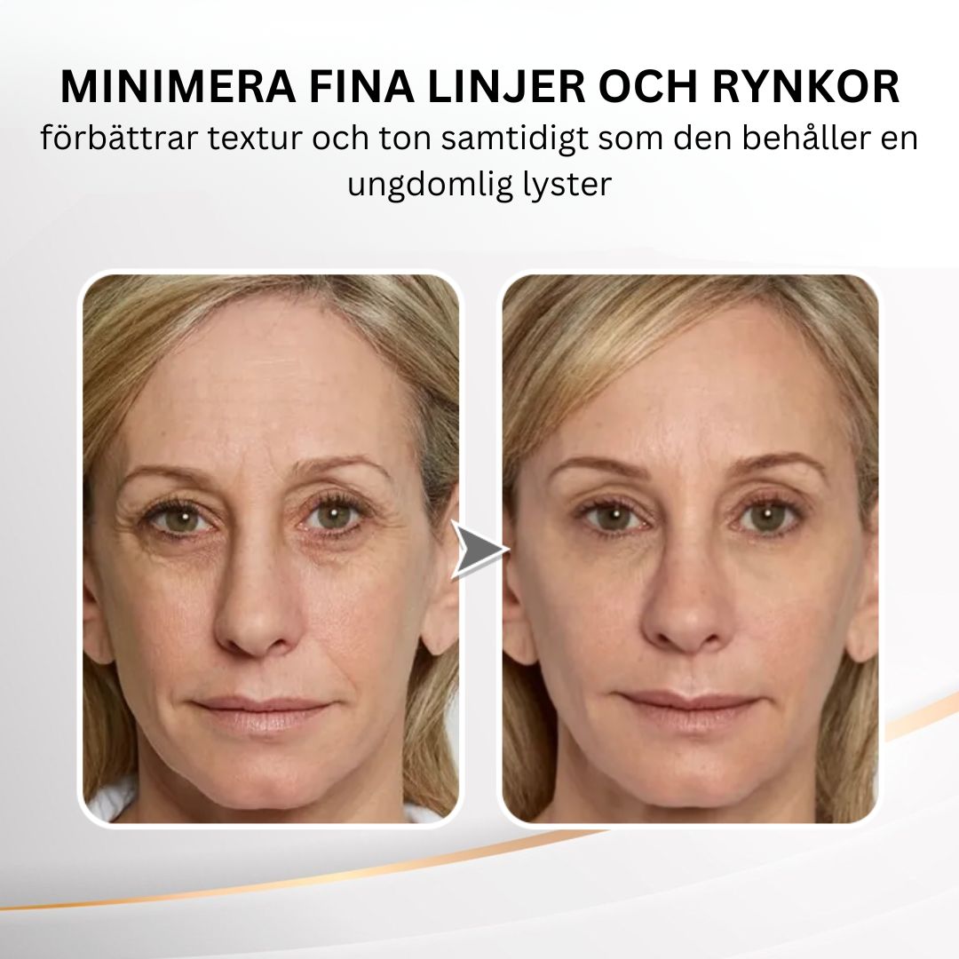 Youthful Lift Eye Uppstramande kräm™