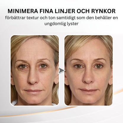 Youthful Lift Eye Uppstramande kräm™