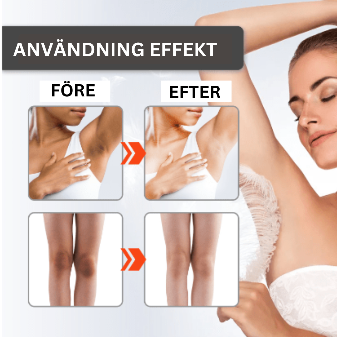 Alvobutik ™ | Advanced Dark Spot Corrector Cream