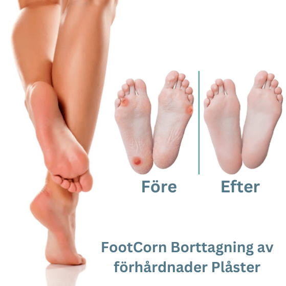 Alvobutik ™ - FootCorn Plåster för avlägsnande av förhårdnader