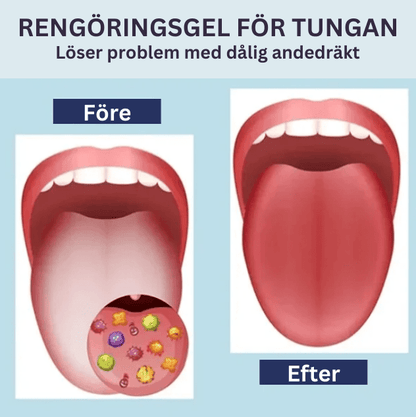 Alvobutik ™ - Set med gel för rengöring av tungan