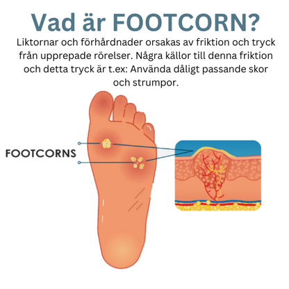 Alvobutik ™ - FootCorn Plåster för avlägsnande av förhårdnader