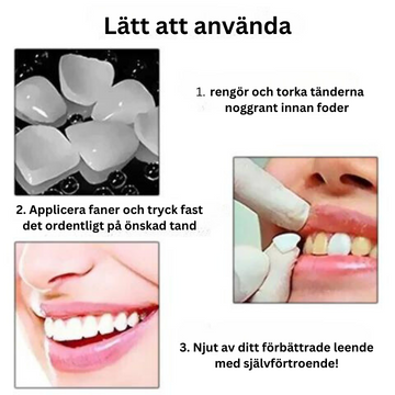 Alvobutik™ Dental tillfällig kronfaner