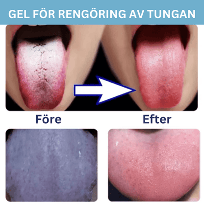 Alvobutik ™ - Set med gel för rengöring av tungan