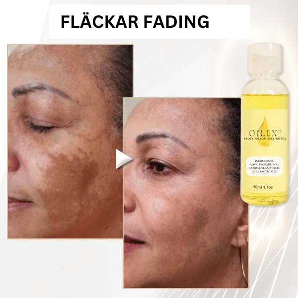 Naturlig fläckljusande gul exfolierande olja™