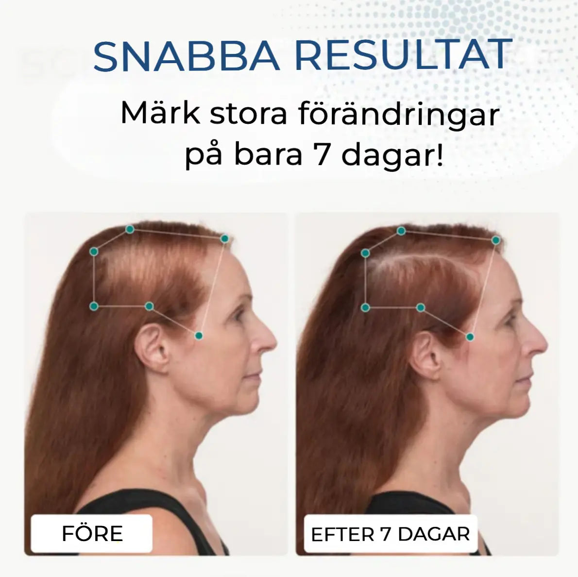 Hårväxtkapslar