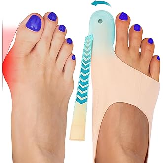 De Ursprungliga Hallux Valgus Korrigeringssockorna™